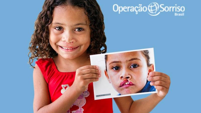 Cirurgias da Operação Sorriso 2023 têm início nesta quarta-feira (18) no Hospital Wilson Rosado