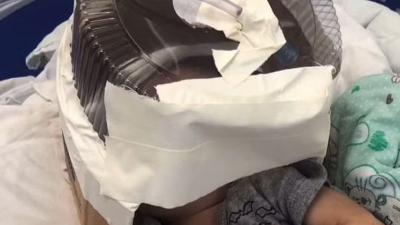 Mãe diz que bebê internado em hospital que usou embalagem de bolo como máscara de oxigênio estava ‘muito debilitado’