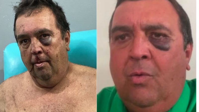 Vereador é agredido e amarrado em sequestro relâmpago no interior do RN; criminosos exigiram transferências